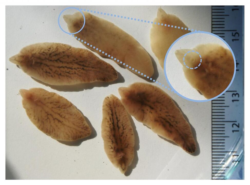 Flukes hepatic