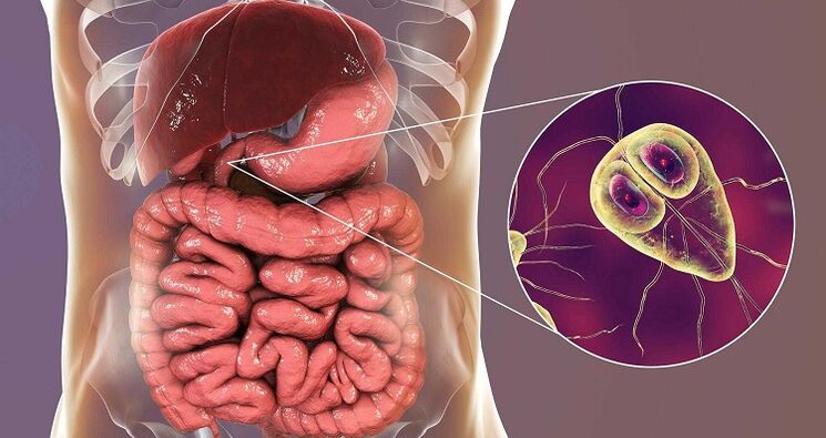 tratarea paraziților în organism cu remedii populare
