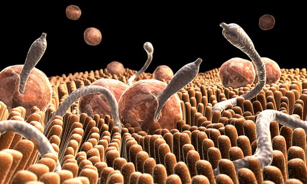 Viermii si parazitii intestinali - Preparate pentru îndepărtarea paraziților din corpul uman