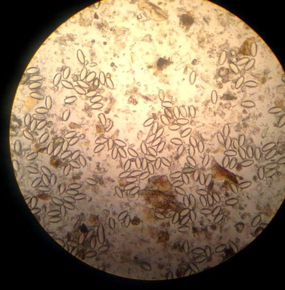 Oxiuriul este un nematod parazit și cu viață liberă. 