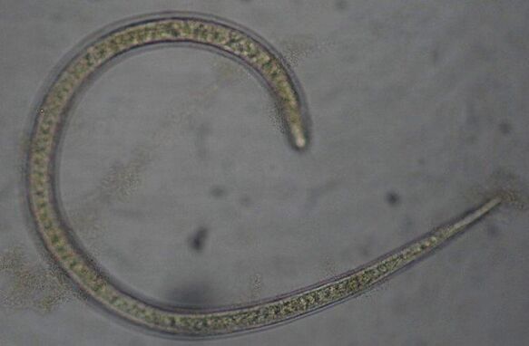 Trichinella este un vierme parazit rotund protostom